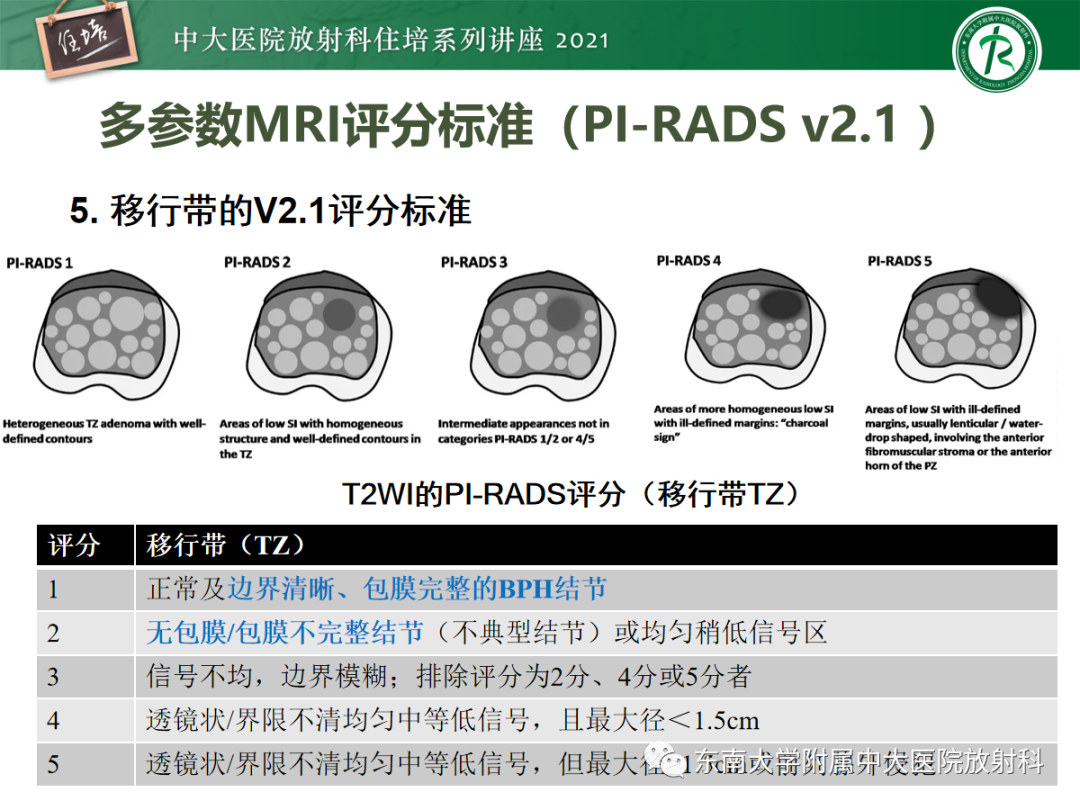 影像PPT - 【PPT】前列腺PI-RADS v2.1要点解读及临床应用-28