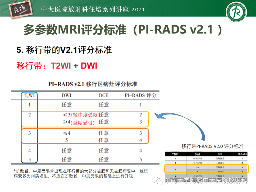 影像PPT - 【PPT】前列腺PI-RADS v2.1要点解读及临床应用-31
