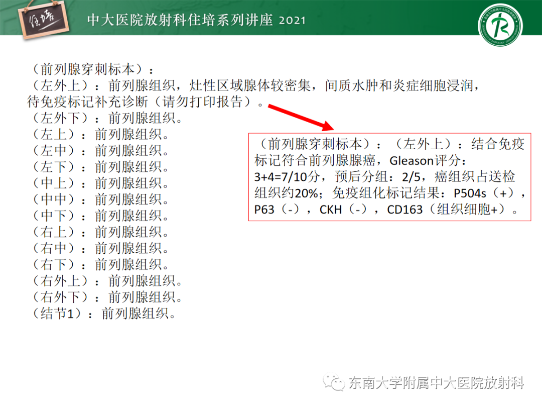 影像PPT - 【PPT】前列腺PI-RADS v2.1要点解读及临床应用-38