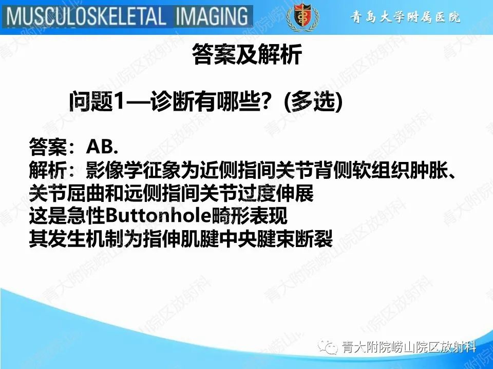 影像PPT - 【PPT】纽扣孔畸形-4