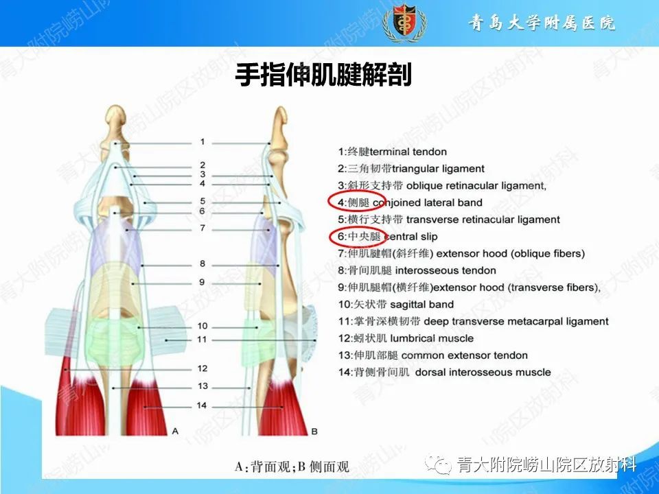 影像PPT - 【PPT】纽扣孔畸形-6