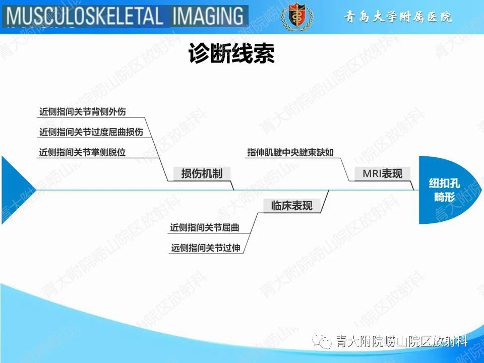 影像PPT - 【PPT】纽扣孔畸形-21