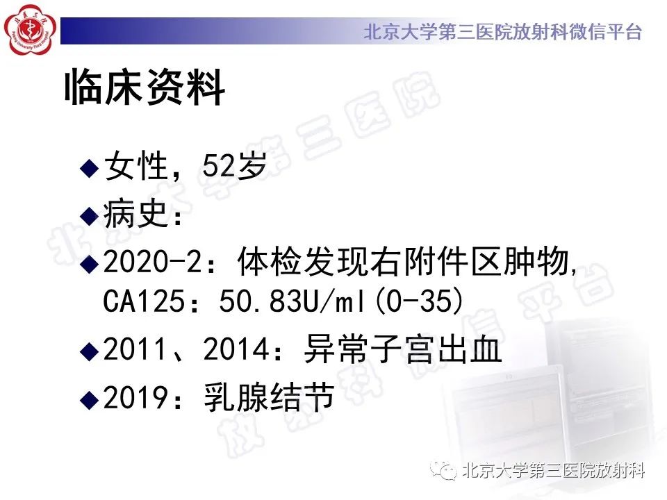 影像PPT - 【PPT】卵巢纤维卵泡膜细胞瘤-2