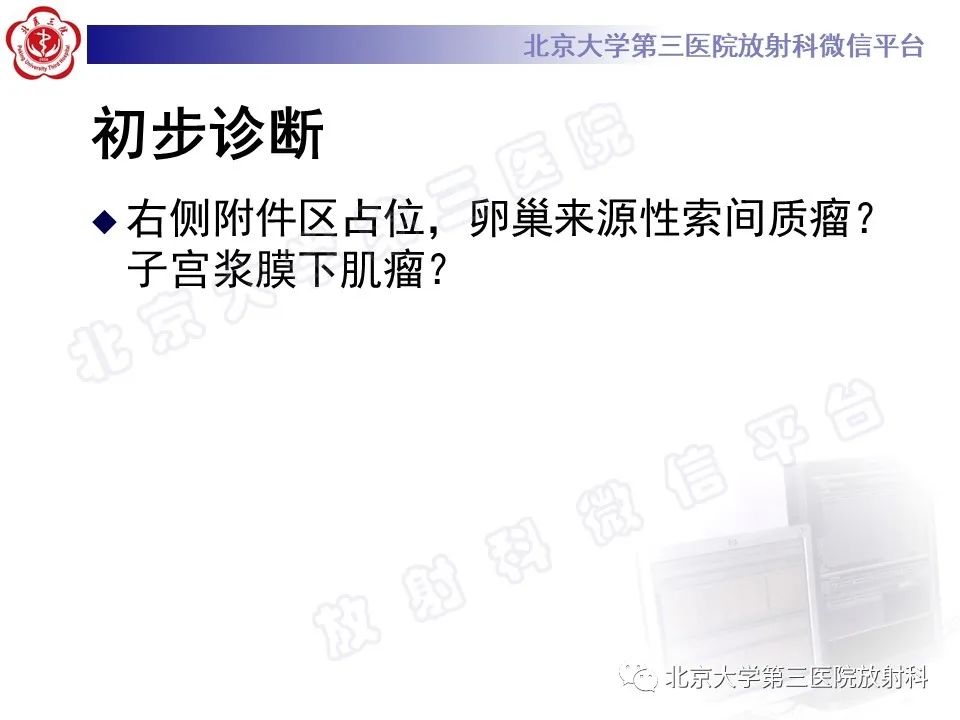 影像PPT - 【PPT】卵巢纤维卵泡膜细胞瘤-8