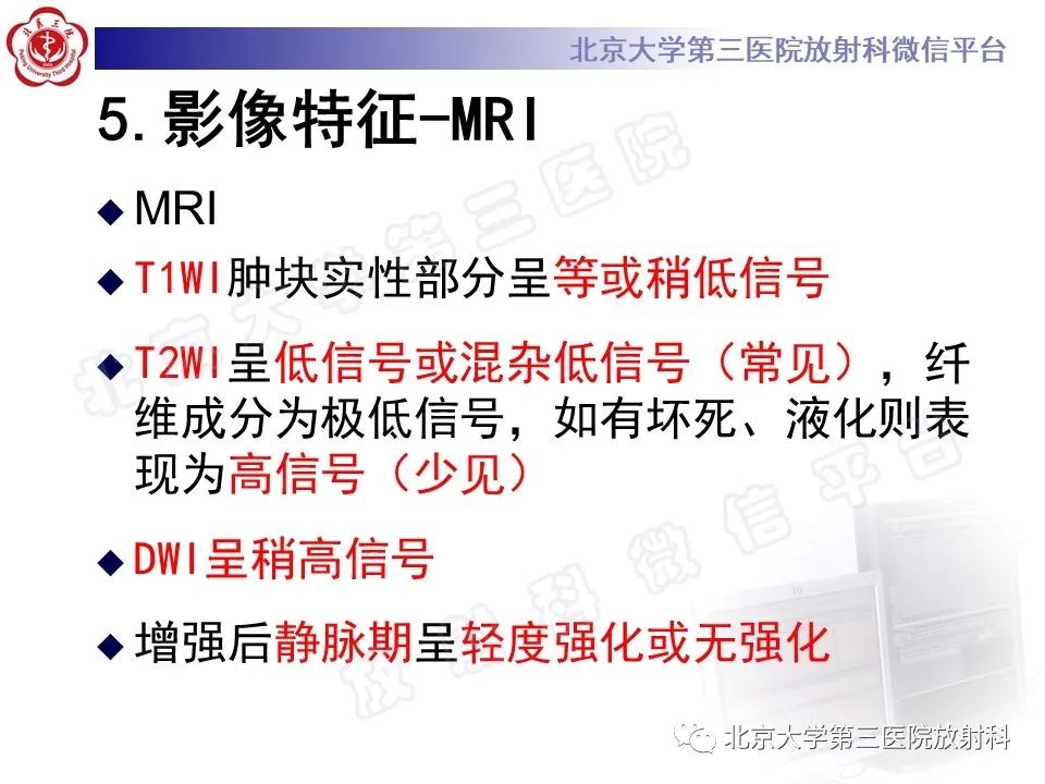 影像PPT - 【PPT】卵巢纤维卵泡膜细胞瘤-19