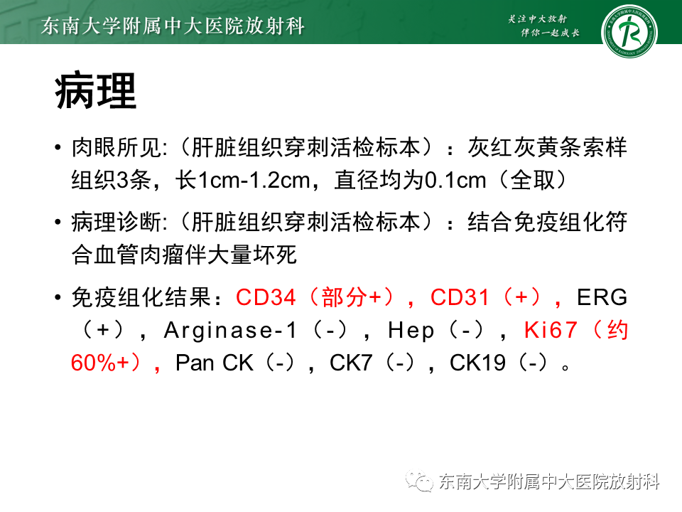 影像PPT - 【PPT】肝脏上皮样血管内皮瘤-22