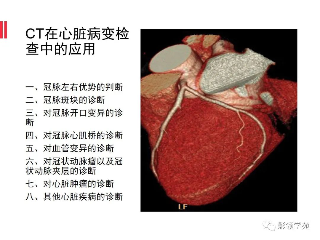 影像PPT - 【PPT】如何分析冠状动脉CTA-8