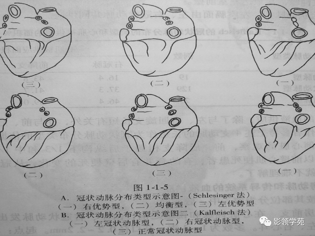 影像PPT - 【PPT】如何分析冠状动脉CTA-14