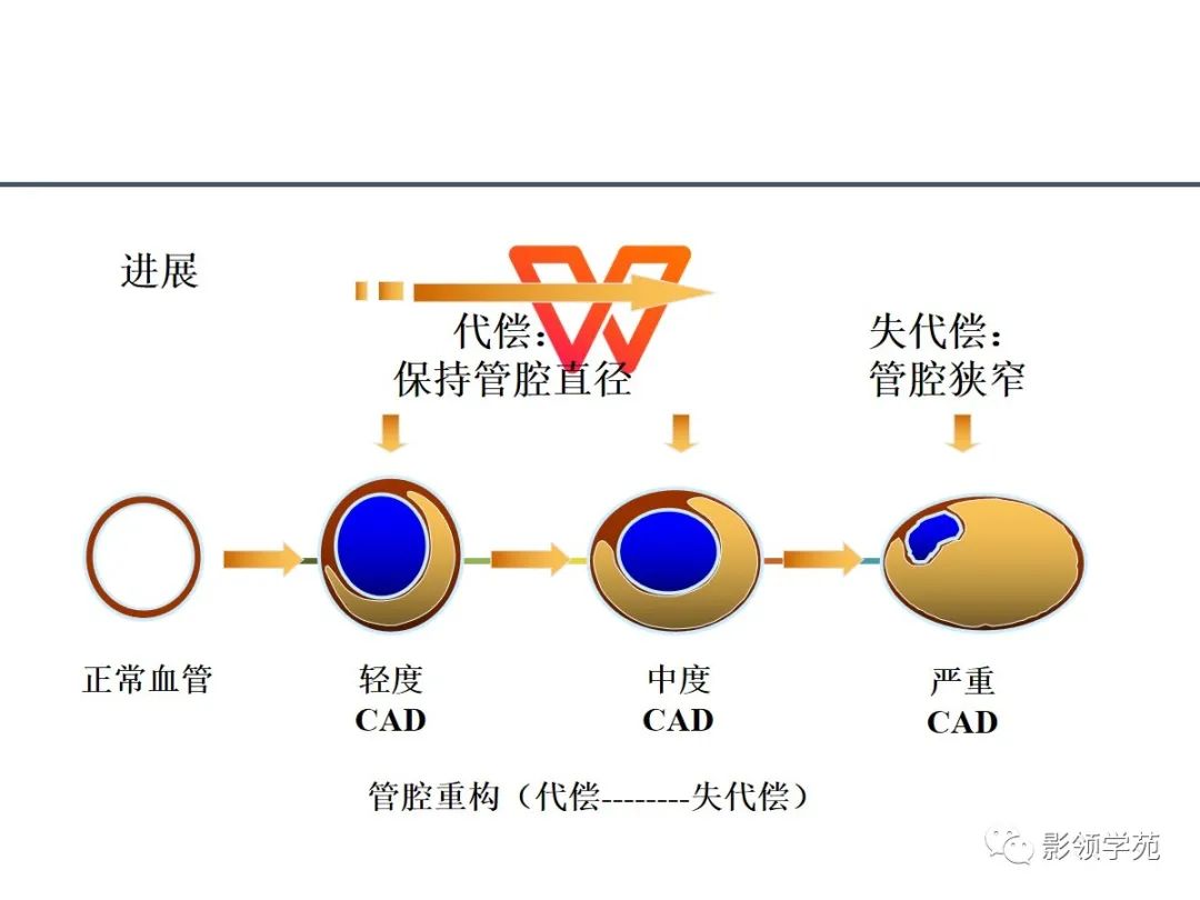 影像PPT - 【PPT】如何分析冠状动脉CTA-22