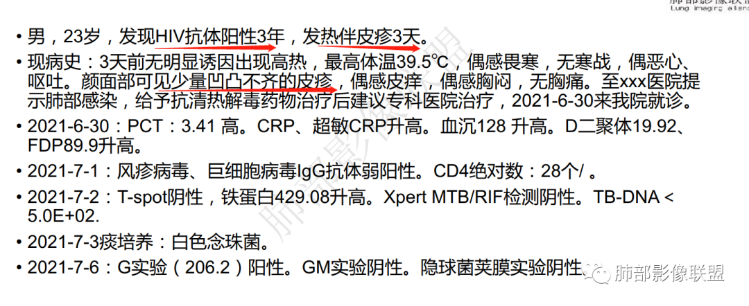 影像PPT - 【病例】马尔尼菲青霉菌病1例肺部CT影像-72 影像PPT - 【病例】马尔尼菲青霉菌病1例肺部CT影像-72
