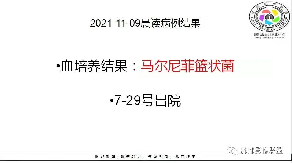 影像PPT - 【病例】马尔尼菲青霉菌病1例肺部CT影像-76 影像PPT - 【病例】马尔尼菲青霉菌病1例肺部CT影像-76