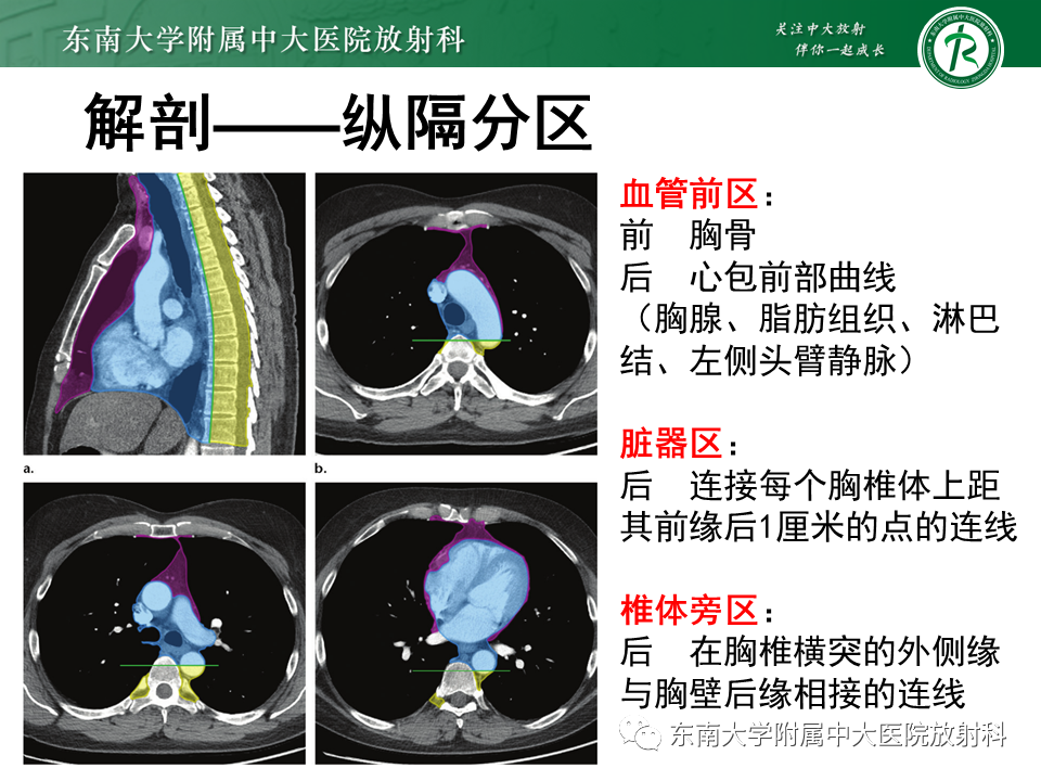 影像PPT - 【PPT】胸腺上皮肿瘤-6
