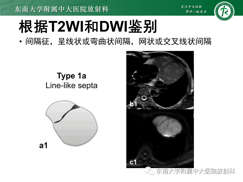 影像PPT - 【PPT】胸腺上皮肿瘤-19