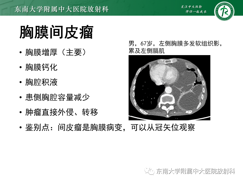 影像PPT - 【PPT】胸腺上皮肿瘤-31