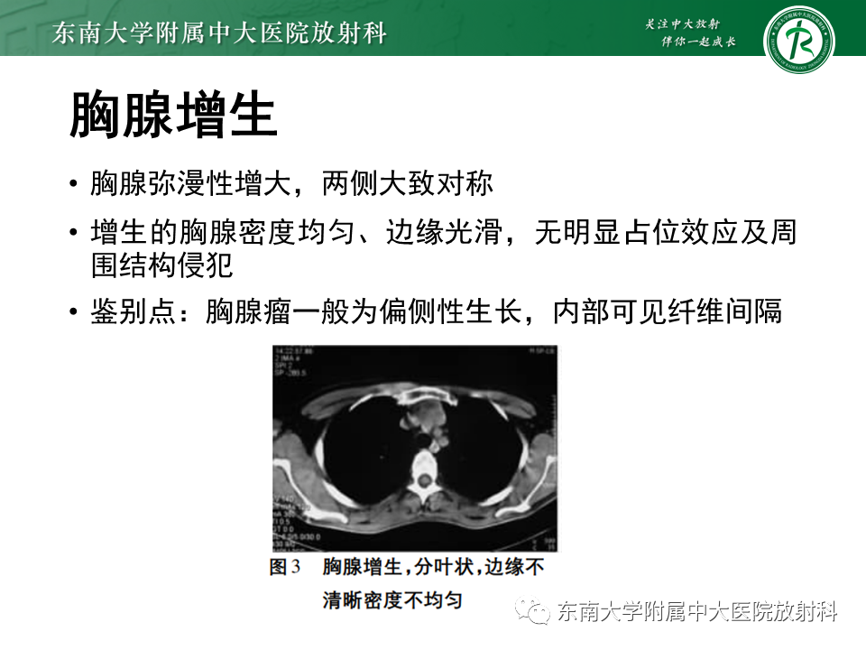影像PPT - 【PPT】胸腺上皮肿瘤-35