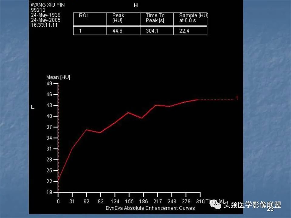 影像PPT - 【PPT】咽旁间隙与咽旁肿瘤的影像诊断-23