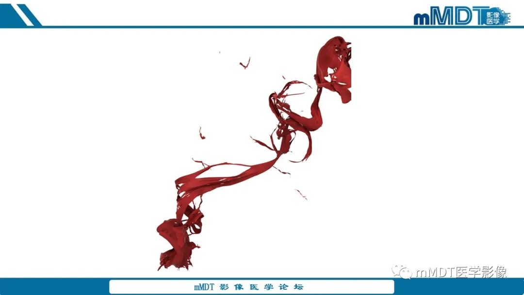 影像PPT - 【病例】盆腔纱布瘤1例MR影像解析-30