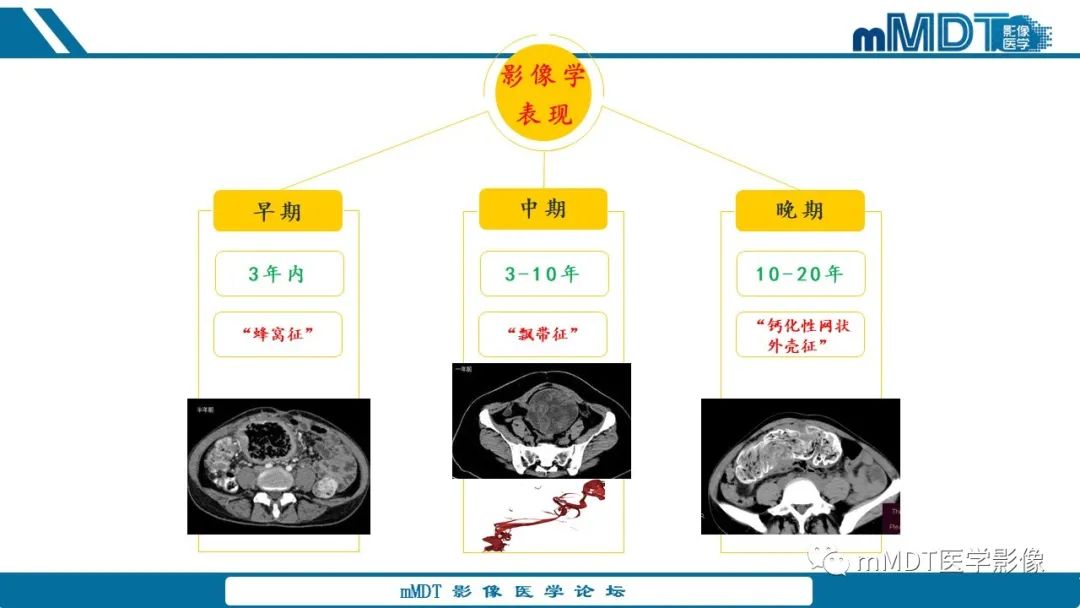 影像PPT - 【病例】盆腔纱布瘤1例MR影像解析-34
