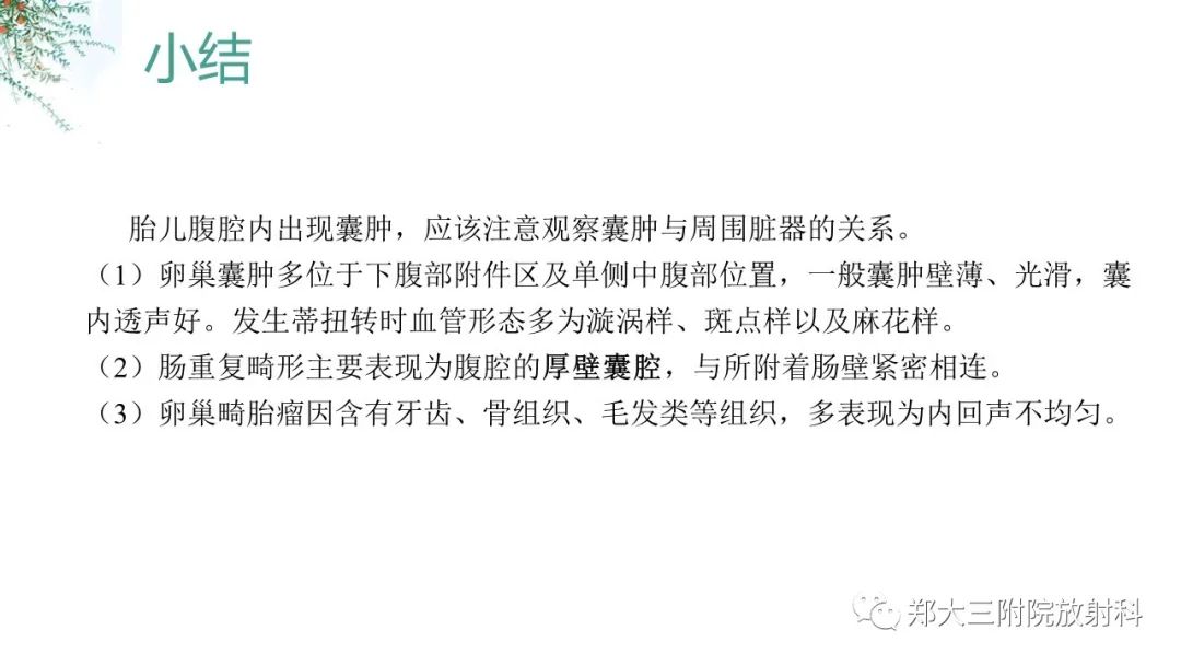影像PPT - 【PPT】卵巢囊肿伴蒂扭转-28