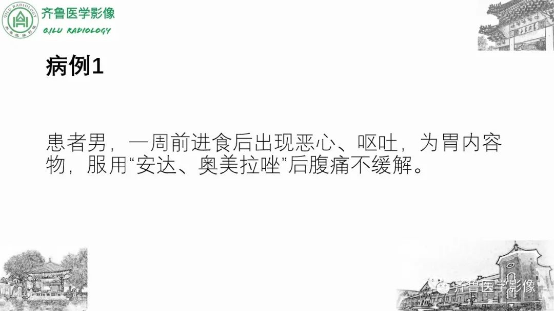 影像PPT - 【PPT】腹部血管压迫综合征-2