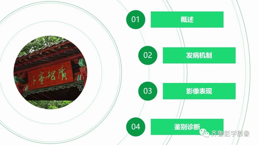 影像PPT - 【PPT】腹部血管压迫综合征-14