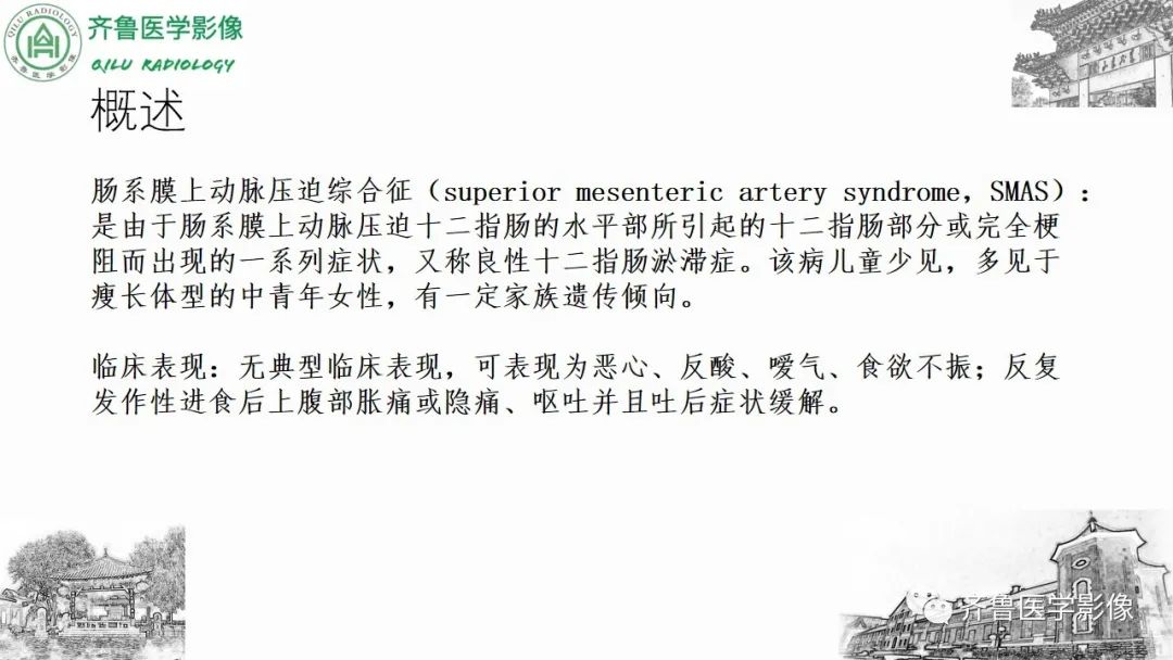 影像PPT - 【PPT】腹部血管压迫综合征-15