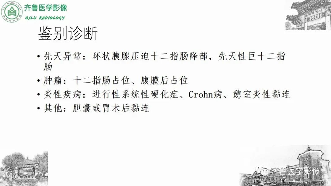 影像PPT - 【PPT】腹部血管压迫综合征-19