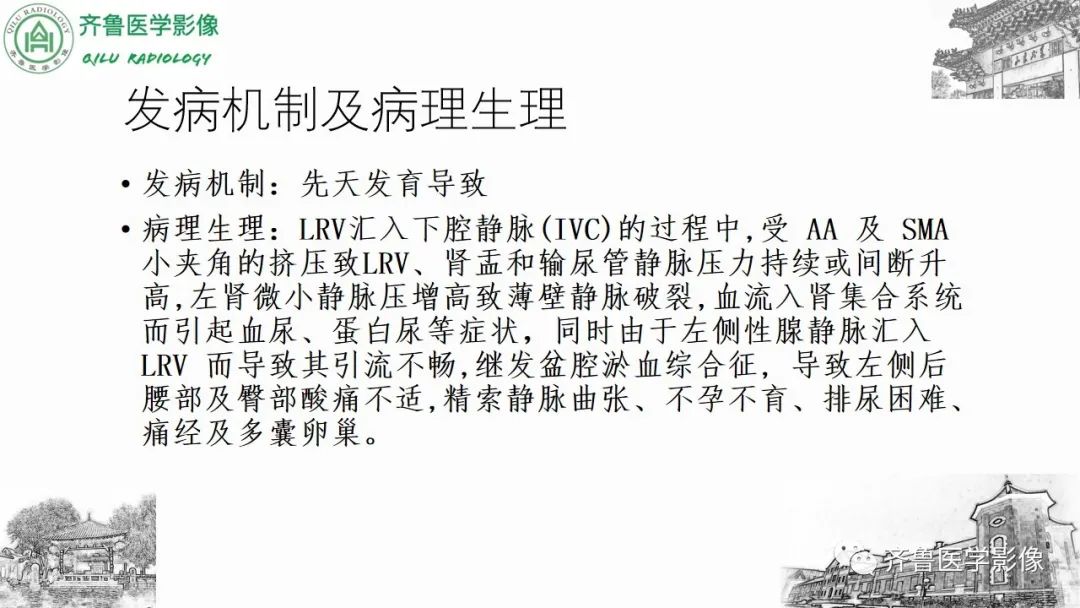 影像PPT - 【PPT】腹部血管压迫综合征-21