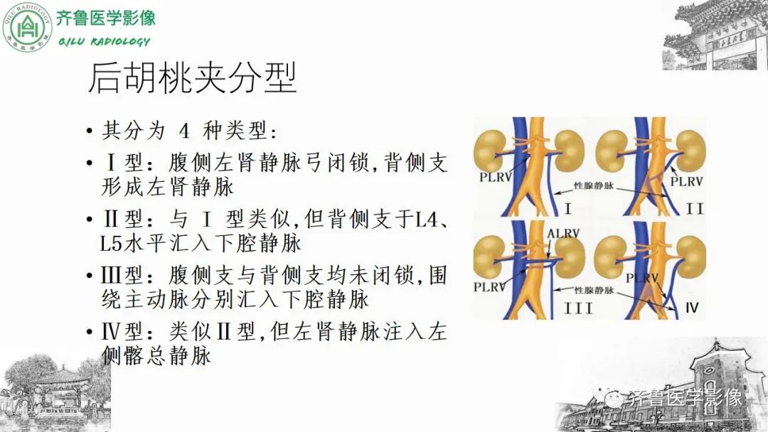 影像PPT - 【PPT】腹部血管压迫综合征-25