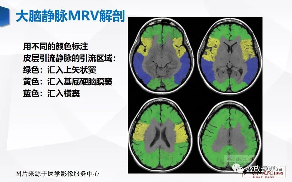 影像PPT - 【PPT】MRV在诊断静脉窦血栓中的作用-5