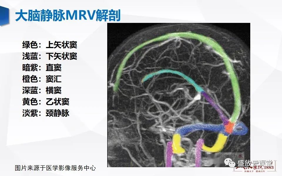 影像PPT - 【PPT】MRV在诊断静脉窦血栓中的作用-4