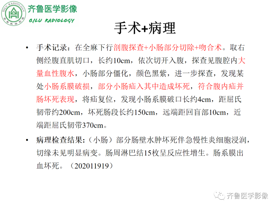 影像PPT - 【PPT】腹内疝-10
