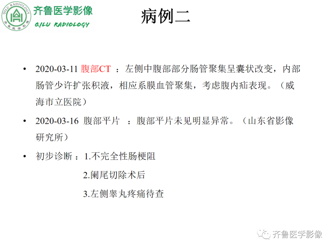 影像PPT - 【PPT】腹内疝-13