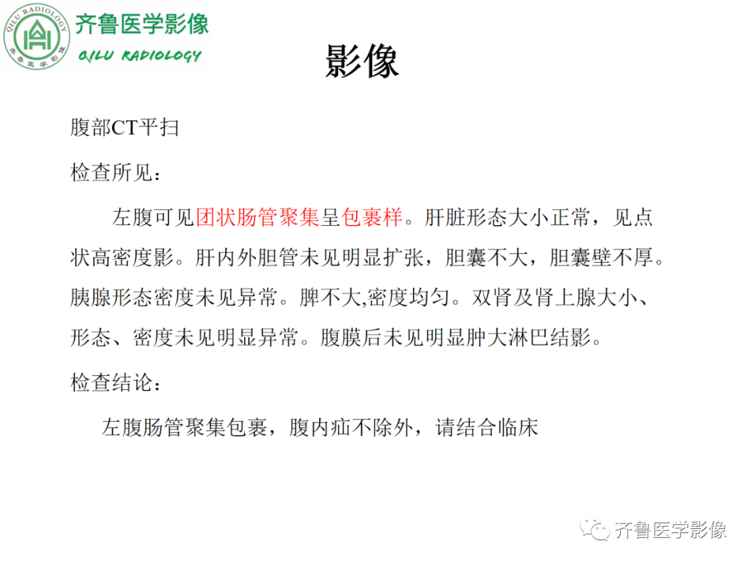 影像PPT - 【PPT】腹内疝-16