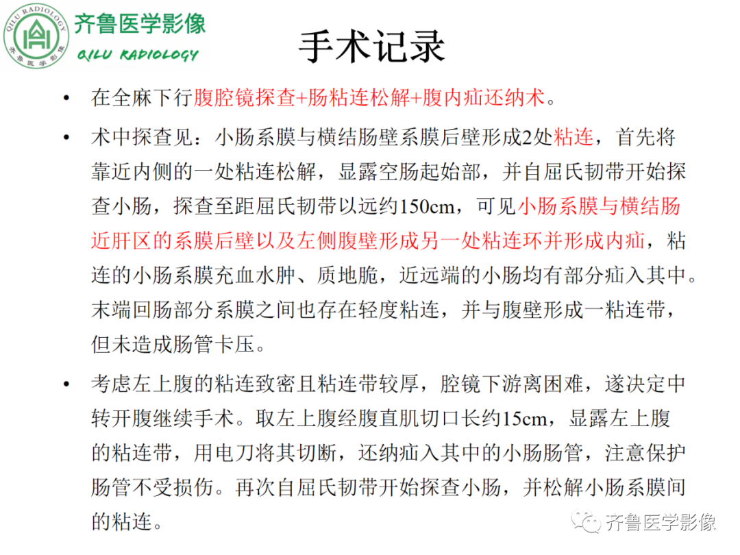影像PPT - 【PPT】腹内疝-17