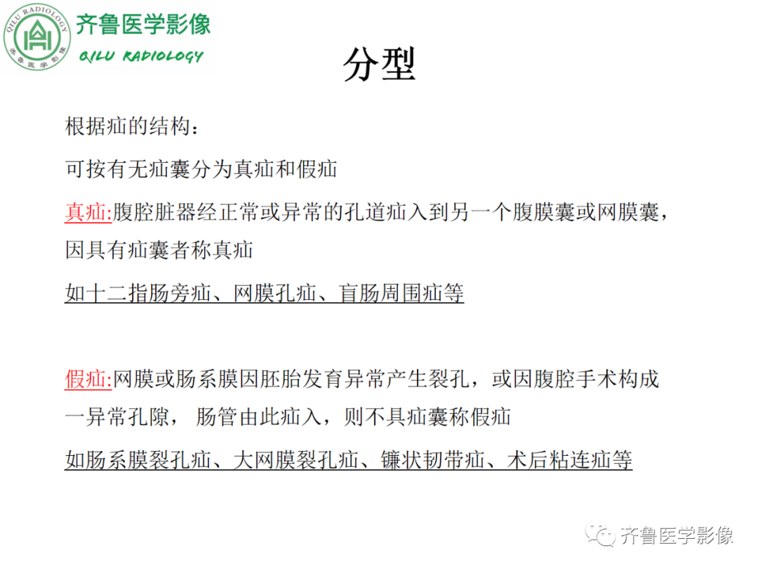 影像PPT - 【PPT】腹内疝-21