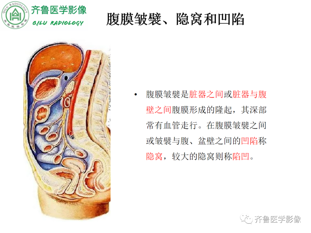 影像PPT - 【PPT】腹内疝-22