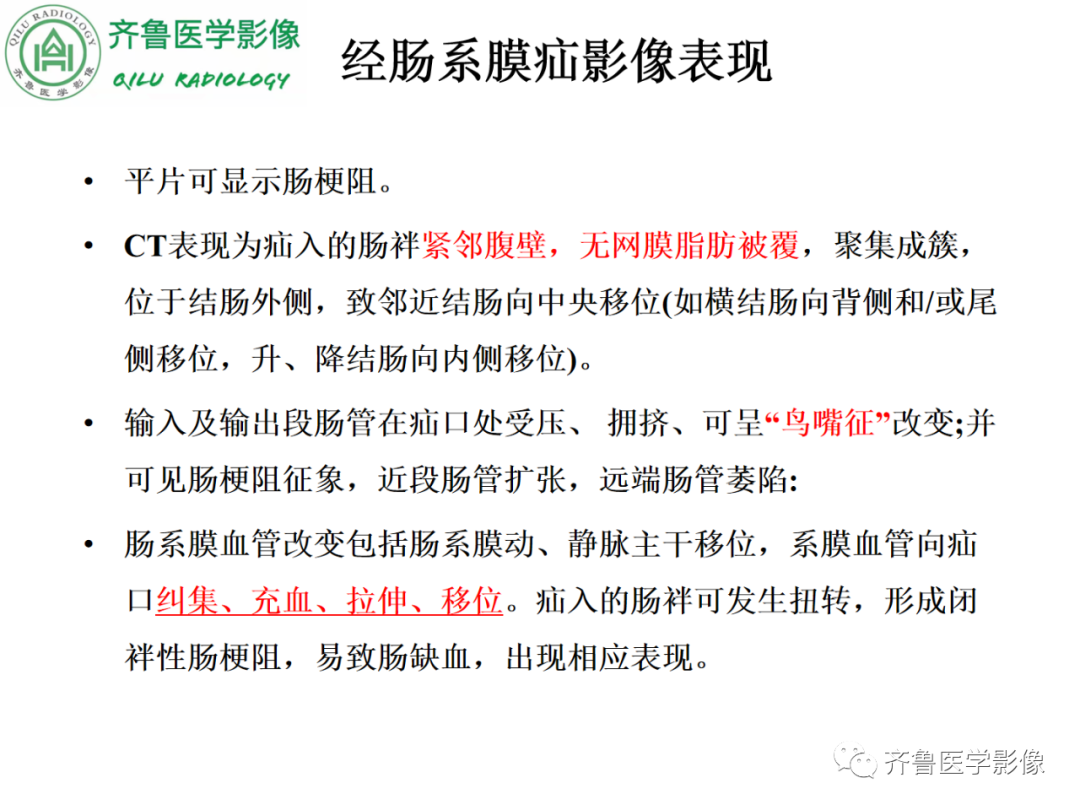 影像PPT - 【PPT】腹内疝-38