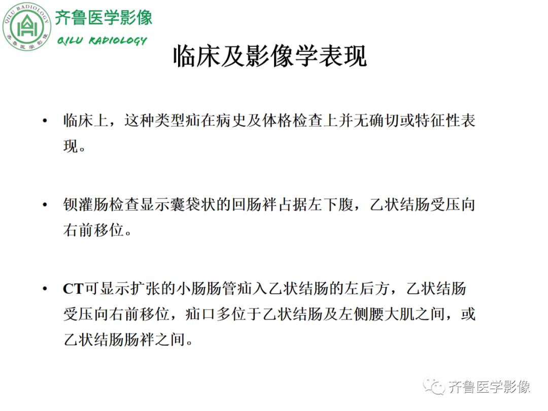 影像PPT - 【PPT】腹内疝-53