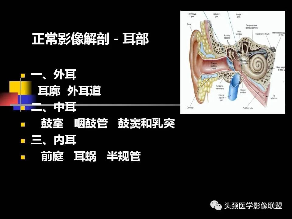 影像PPT - 【PPT】中耳乳突解剖及常见疾病-4