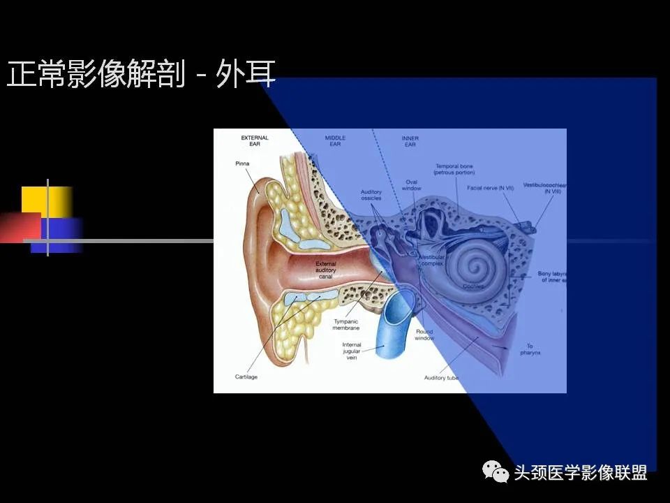 影像PPT - 【PPT】中耳乳突解剖及常见疾病-6