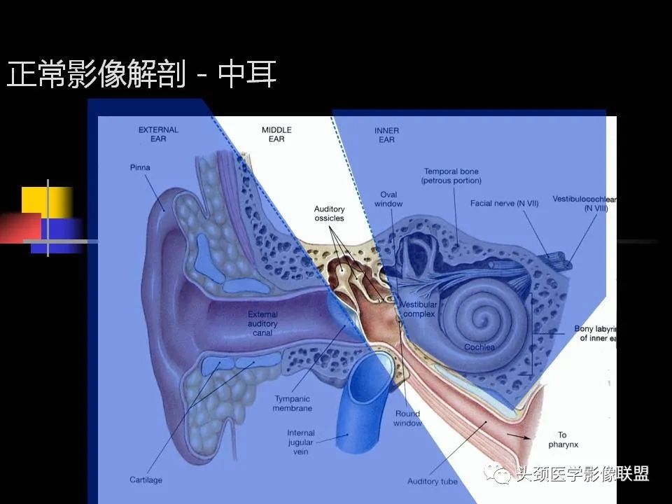 影像PPT - 【PPT】中耳乳突解剖及常见疾病-8