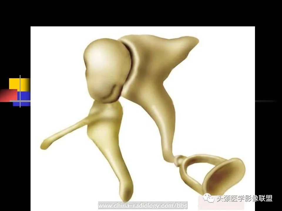 影像PPT - 【PPT】中耳乳突解剖及常见疾病-18