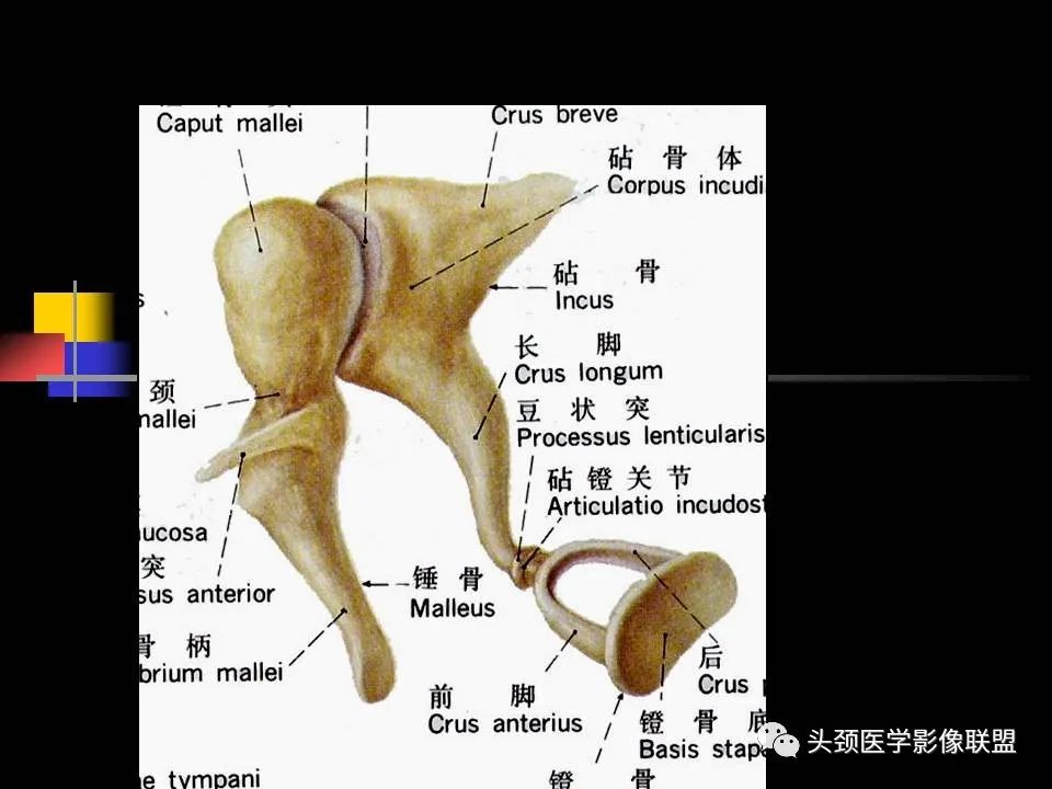 影像PPT - 【PPT】中耳乳突解剖及常见疾病-19