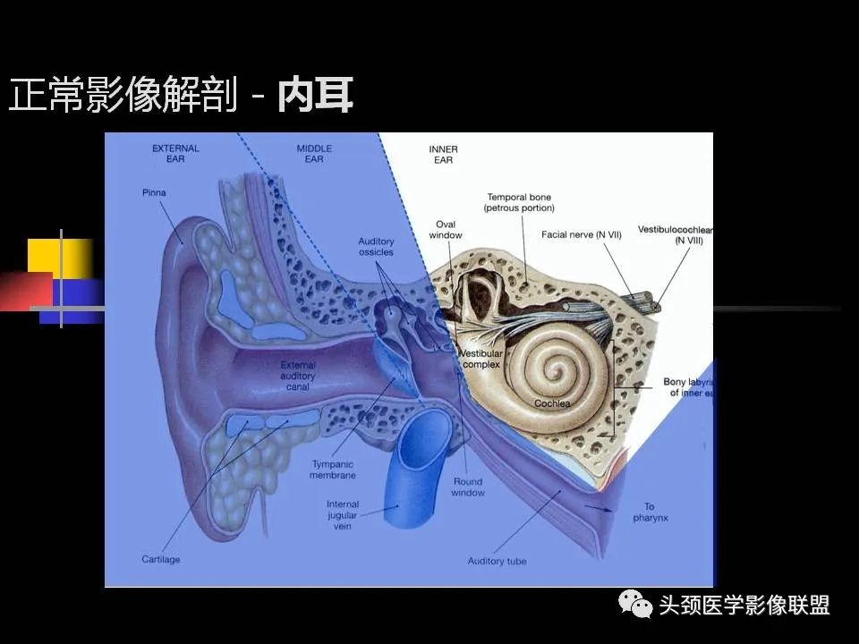 影像PPT - 【PPT】中耳乳突解剖及常见疾病-28