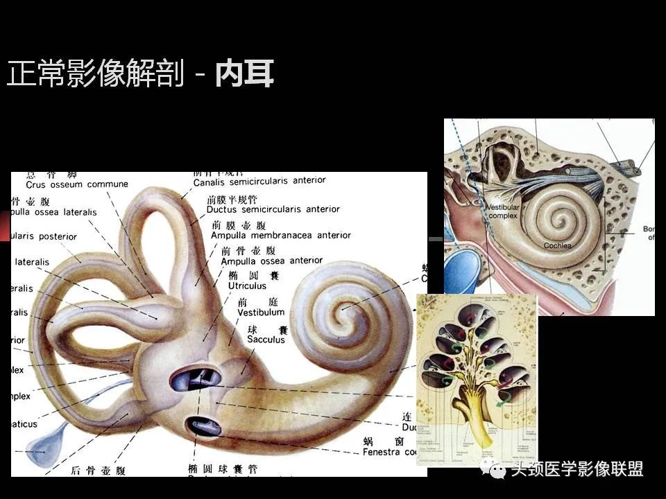 影像PPT - 【PPT】中耳乳突解剖及常见疾病-29