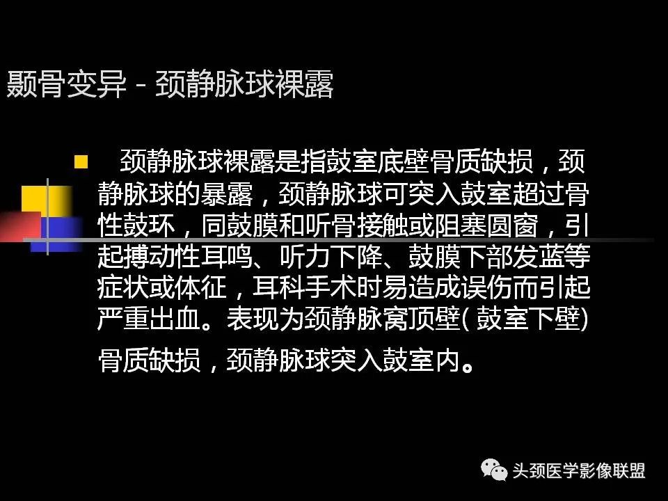 影像PPT - 【PPT】中耳乳突解剖及常见疾病-54