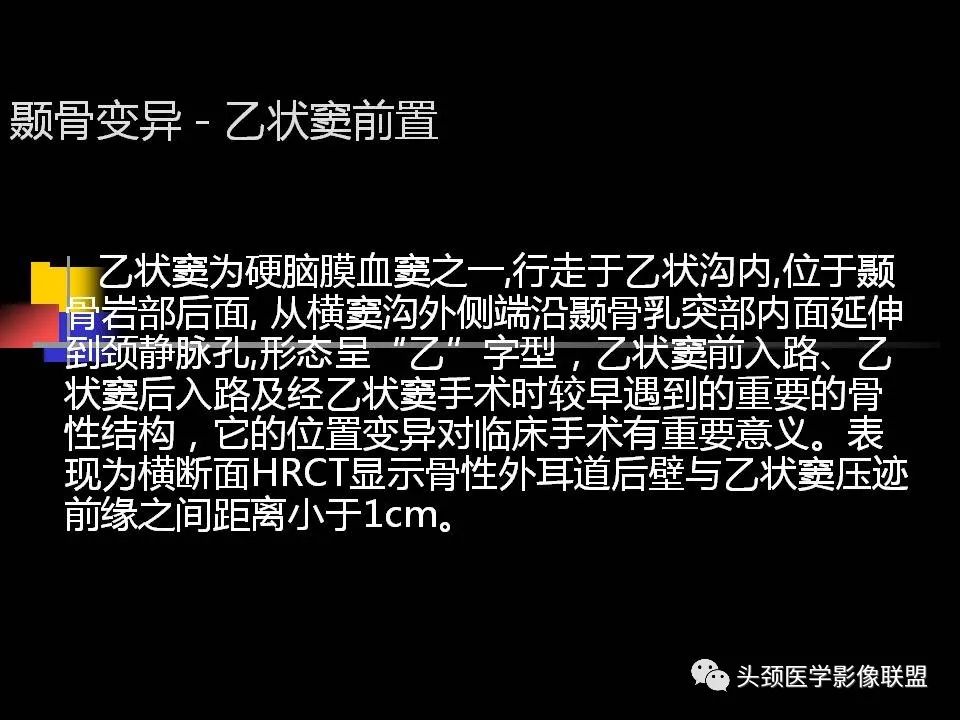 影像PPT - 【PPT】中耳乳突解剖及常见疾病-56