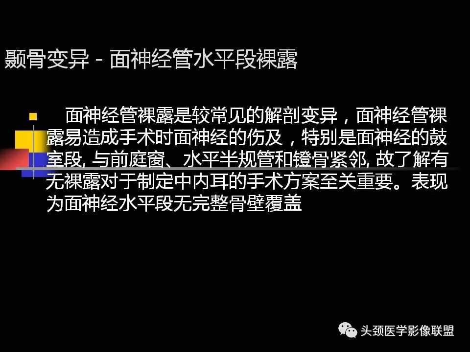 影像PPT - 【PPT】中耳乳突解剖及常见疾病-60