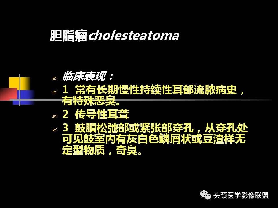 影像PPT - 【PPT】中耳乳突解剖及常见疾病-73